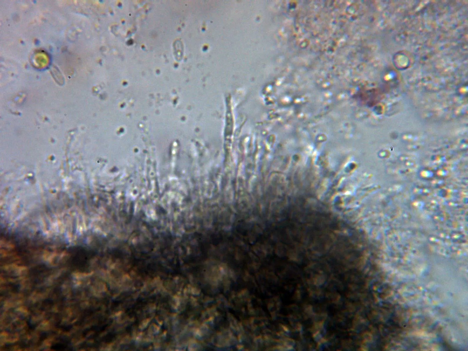 Microscopía de Melanconium hedericola - 12 - Hifas 1